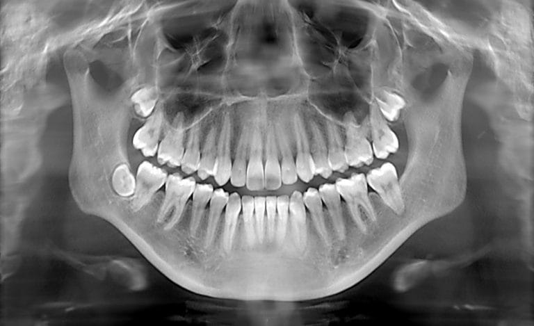 dental xrays port washington ny