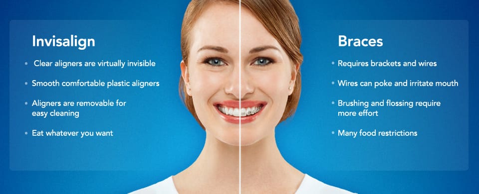 Orthodontics and Invisalign