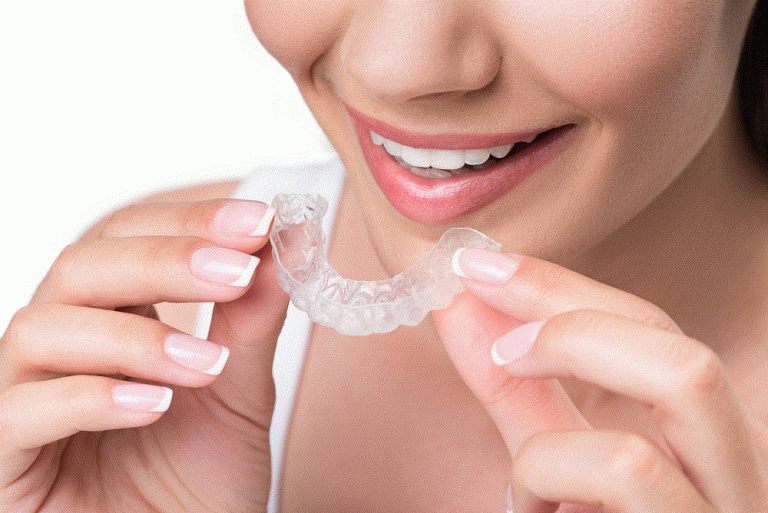improve your smile with invisalign